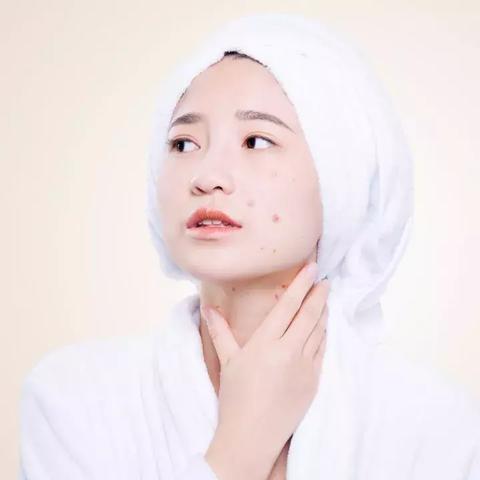 最新Plasma去痘坑技术,重塑肌肤的理想之选