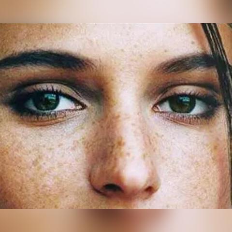 美国疱疹二型最新研究进展综述