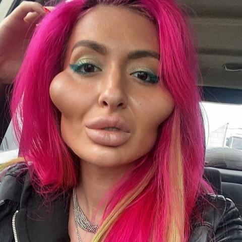 最新小拉皮手术，重塑青春容颜的秘诀